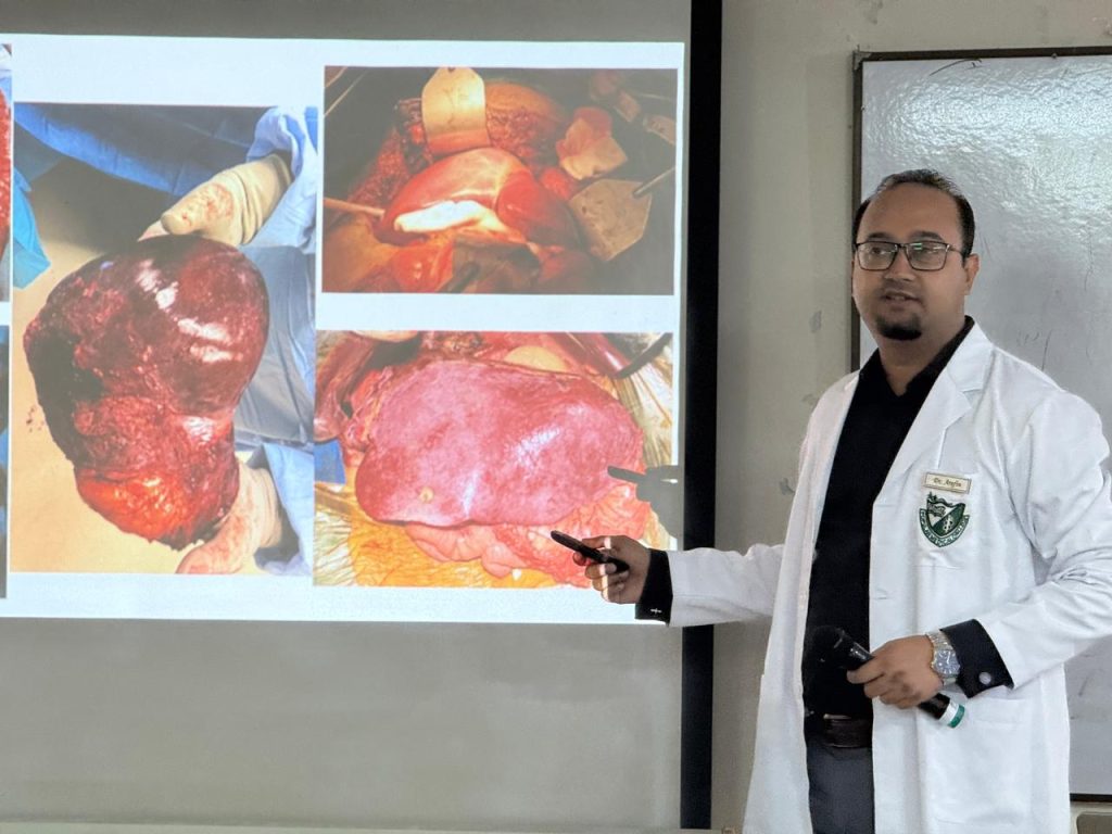 Spleen Tumor Diagnosis and Treatment Guide With Imaging, Biopsy Decisions, and Care Planning