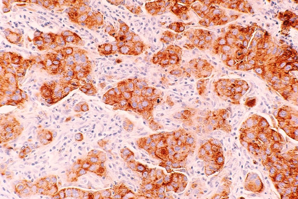 Understanding Hepatobiliary Diseases: A Comprehensive Overview