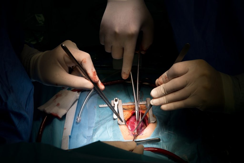Gallbladder Polyps Treatment in Dhaka: When is Surgery Necessary? | Dr. Arefin