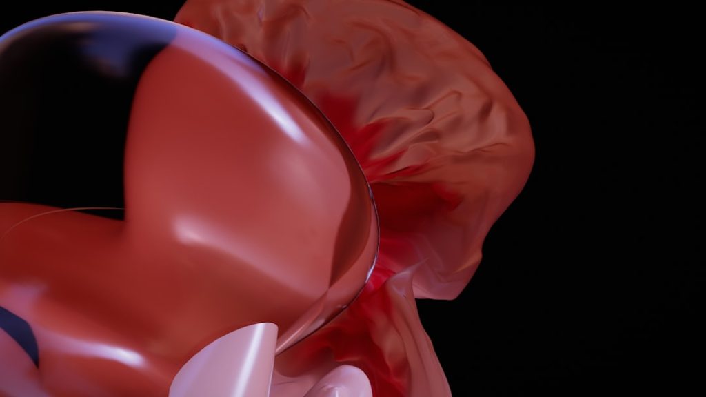 Liver Cirrhosis Treatment in Bangladesh | Dr. Murshidul Arefin