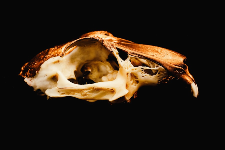 Spleen Tumor Diagnosis