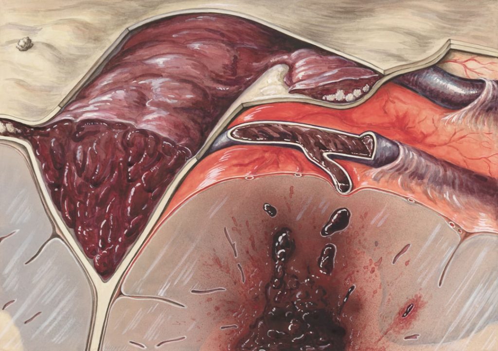 Spleen Size Explained With Normal Range, When It’s Enlarged, and What Tests Confirm It