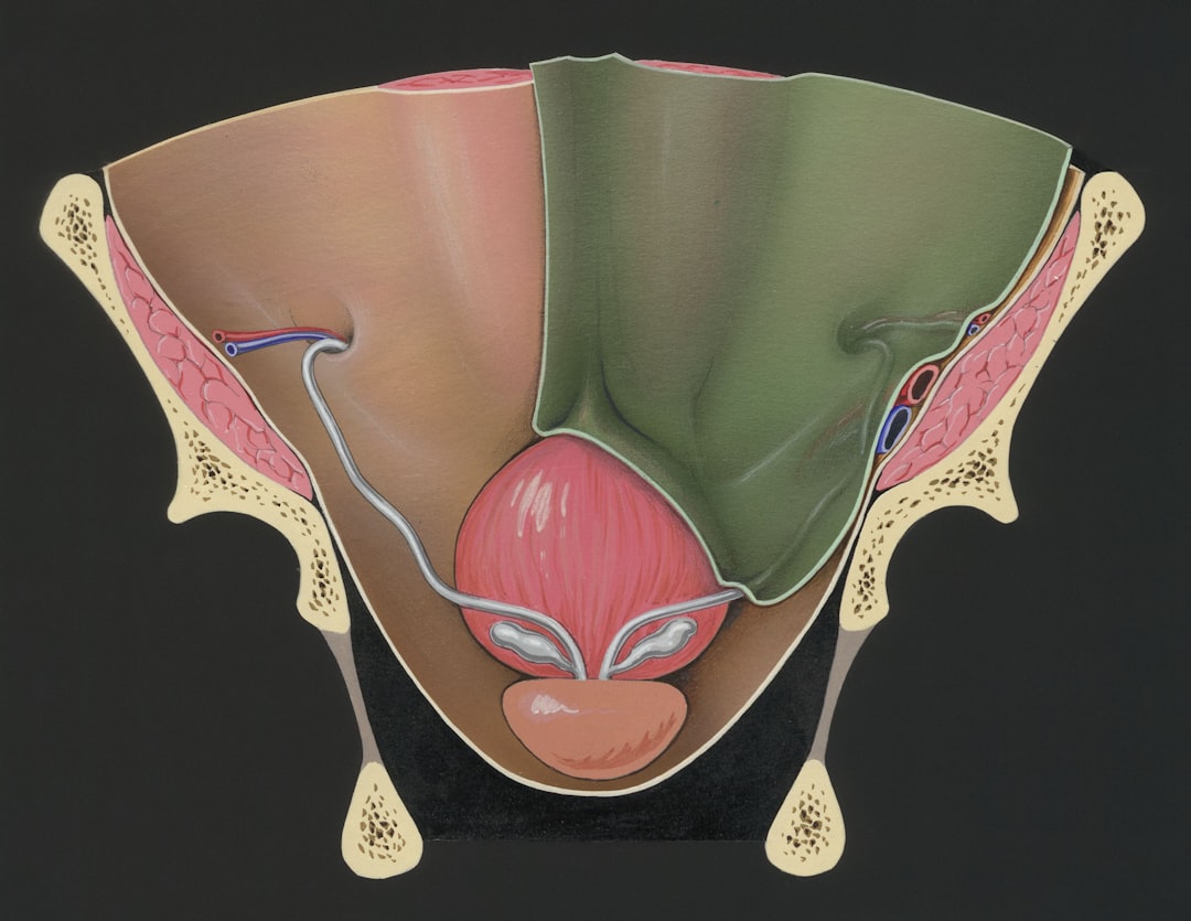 Photo Duodenum Ulcer Treatment Guide