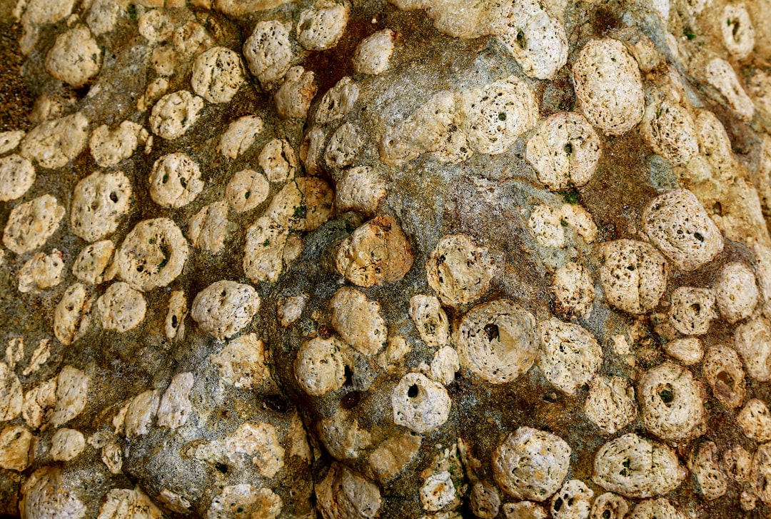 Photo Gall Bladder Stones