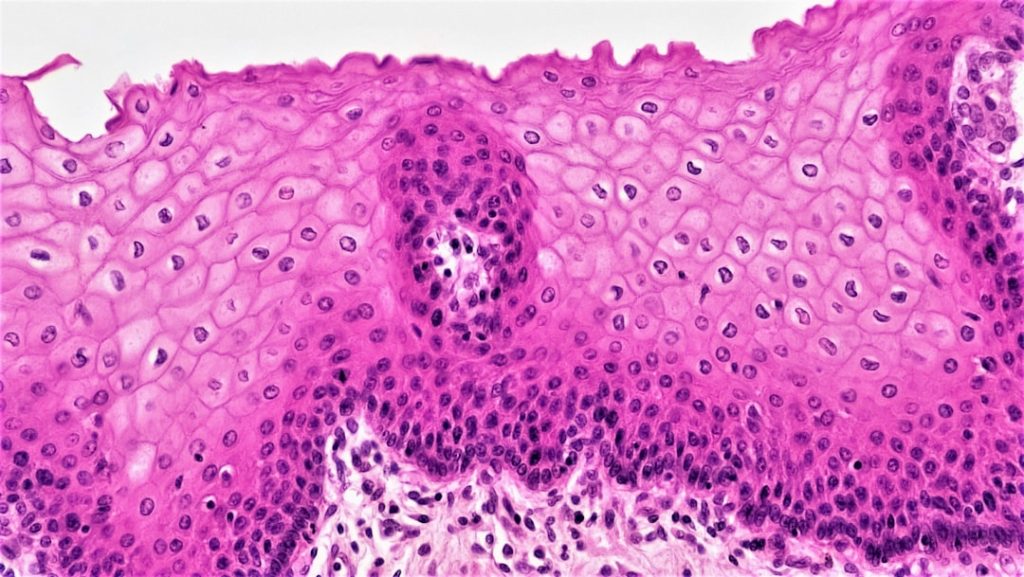 Gastric Cancer Diagnosis and Treatment With Early Warning Signs, Staging Workup, and Modern Care Pathways