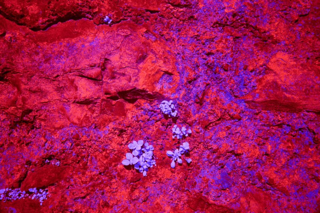 Pancreatic Tumor Diagnosis and Treatment Guide With Staging, Imaging, and Care Planning