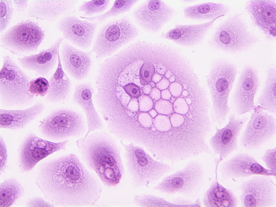 Photo Pancreatic Cyst Guide