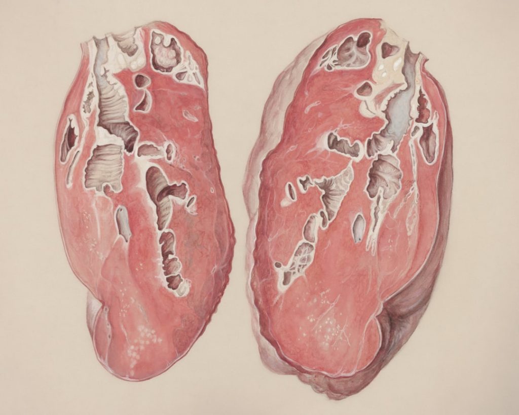 Liver Tumor Evaluation and Treatment With Imaging Based Diagnosis, Staging, and Definitive Care Options