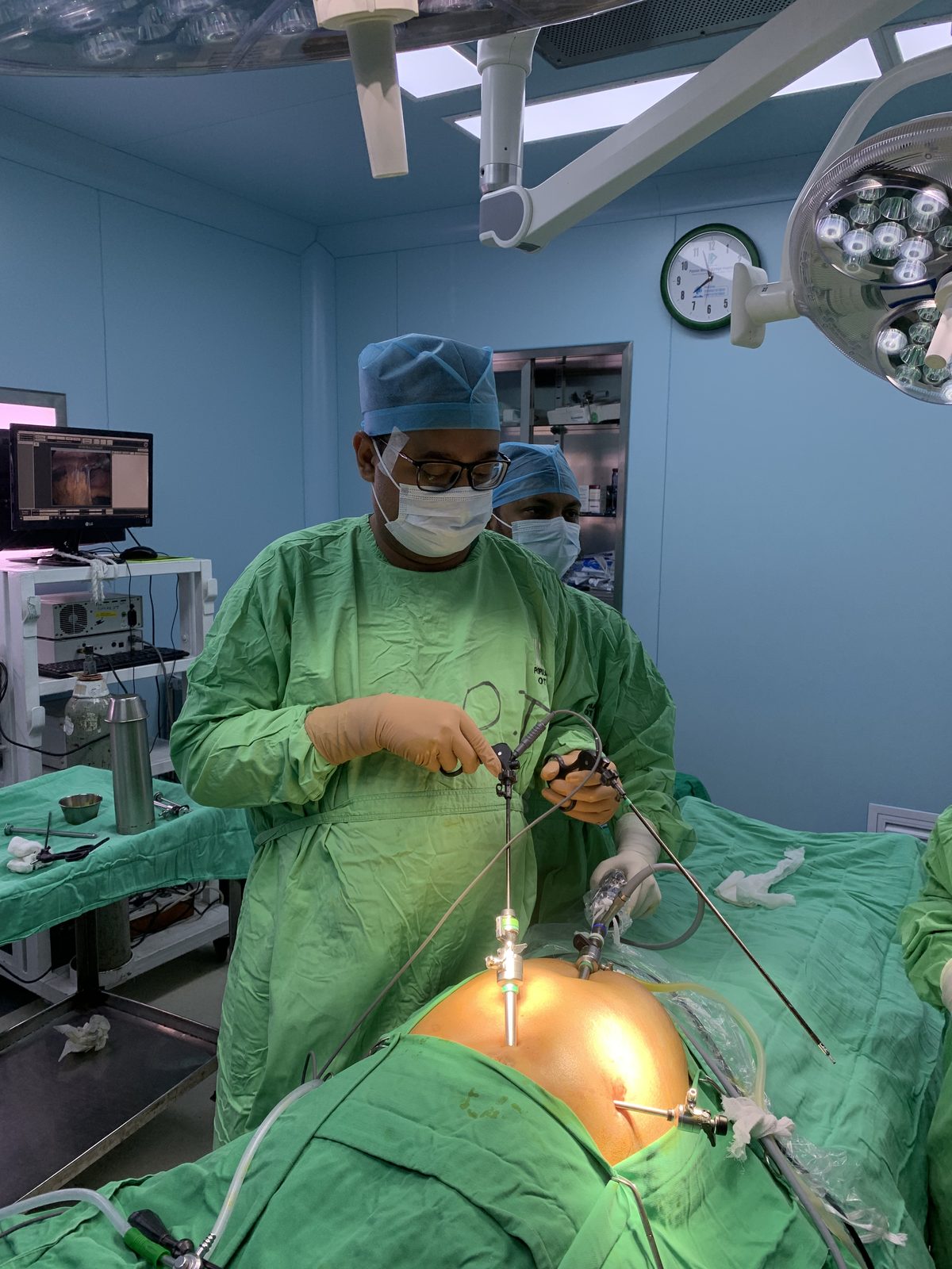 Clinicians performing laparoscopic choledochal cyst surgery Dhaka in a sterile operating theatre.